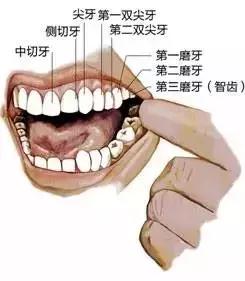 惊拔智齿原来可以如此简单高效